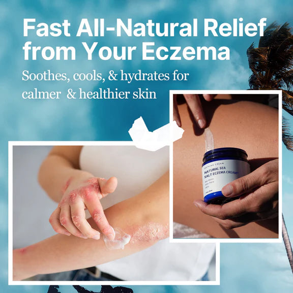 Natural Soothing Cream - Sea Moss Colloidal Oats - for Eczema Psoriasis Prone Skin - Minerals from The Sea - for Sensitive Skin - Hydrating Eczema Cream for Dry Skin