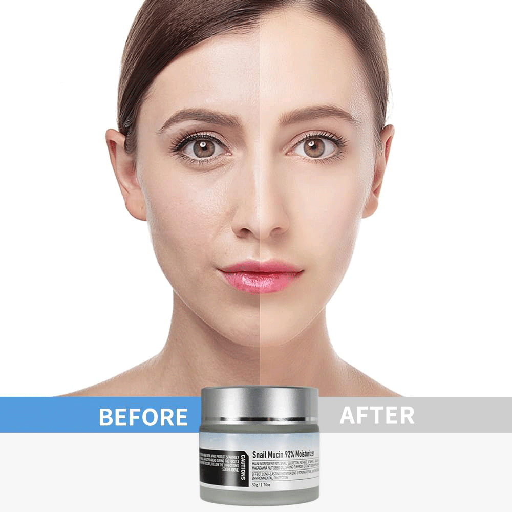 Face Moisturizer Hydrating Repair Face Gel Cream for Dry & Sensitive Skin, All Skin Types