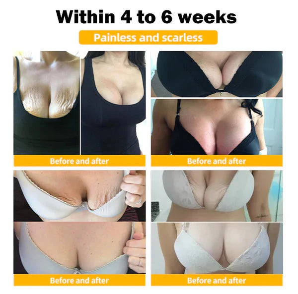 (Official Brand Store ) 🤰 LuvSnap™ 100% Natural Sagging Repair Patch or Breast Enhancement Patch